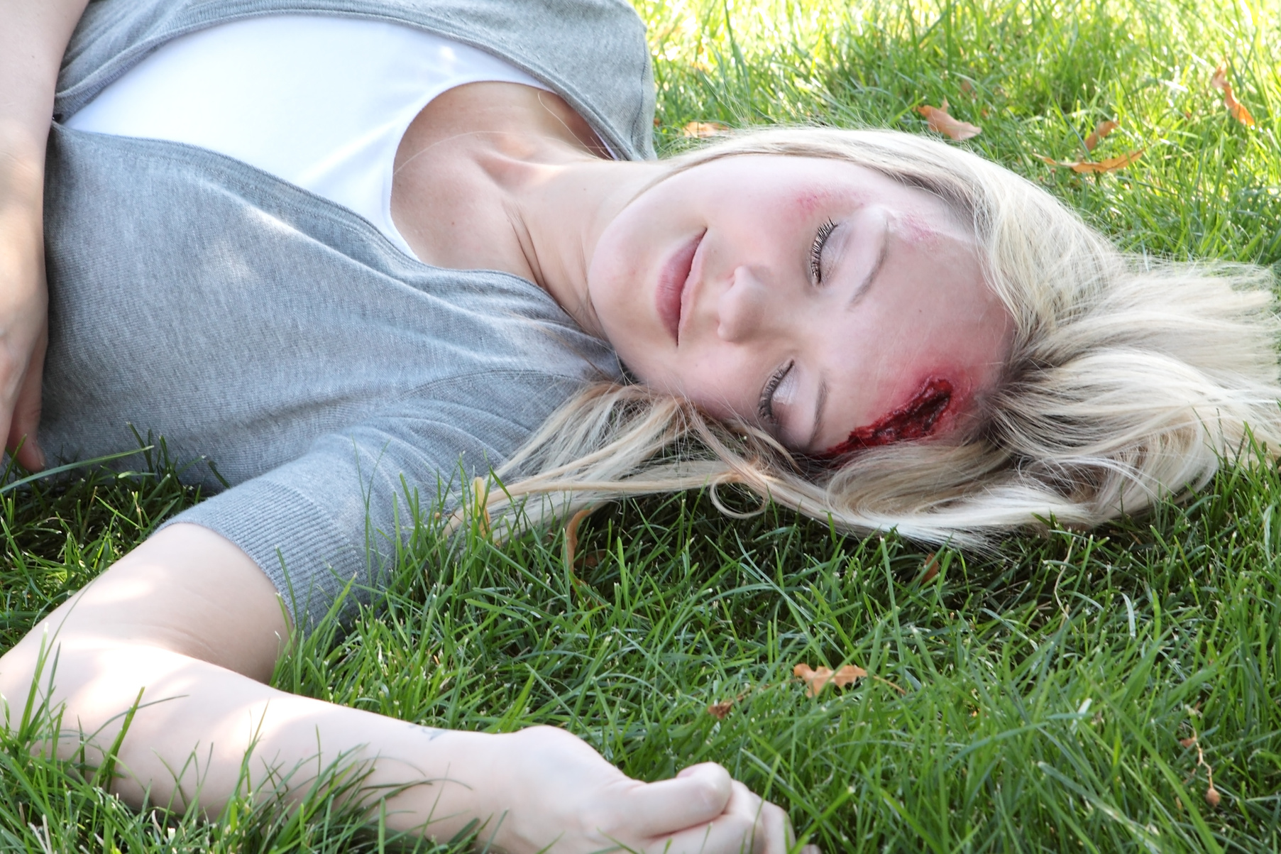 Head injury